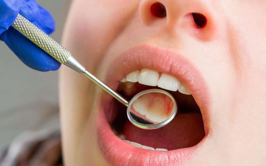 10 Important Questions To Ask Your Dentist