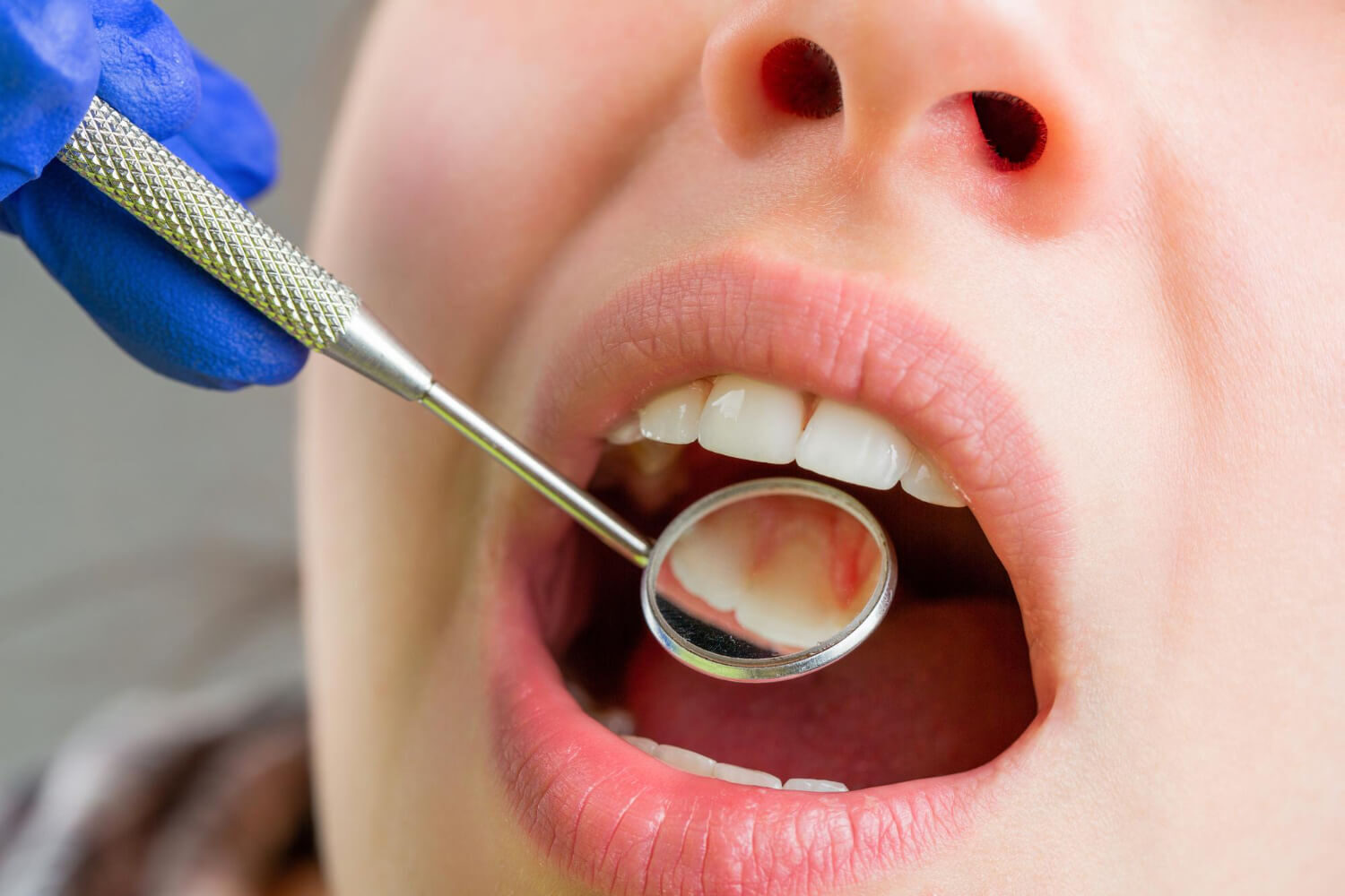 $variable({"type":"content","value":{"name":"site_title","settings":{"before":"Achieve your best smile at ","after":""}}})$