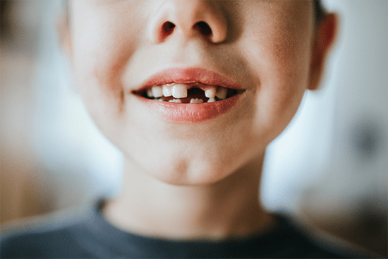 Child with missing tooth