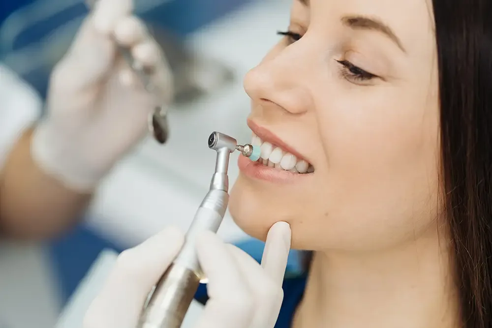Dental polishing procedure