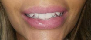 Patient Before Photo