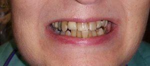 Patient Before Photo
