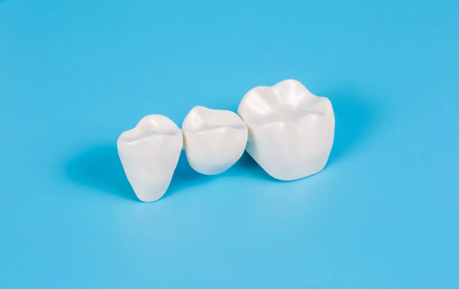 Dental Crowns & Bridges